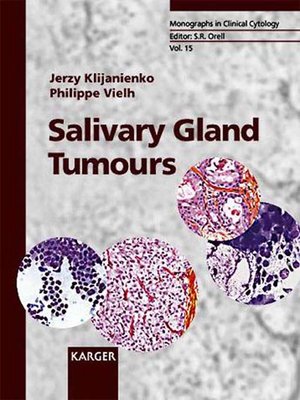 cover image of Salivary Gland Tumors